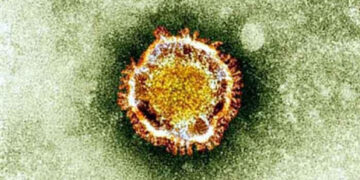 Coronavirus in Ivory Coast