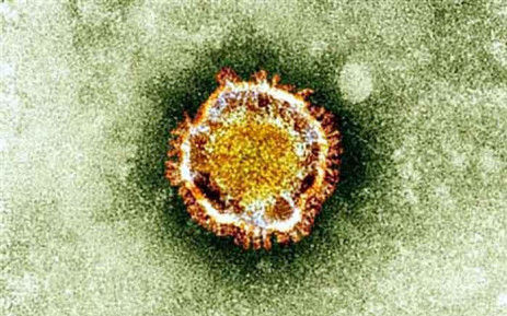 Coronavirus in Ivory Coast